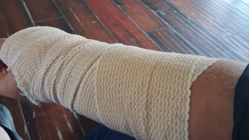 Santa Maria Man Says He Was Beaten and Hospitalized By Federal Agents Wednesday Santa Maria Man Says He Was Beaten and Hospitalized By Federal Agents Wednesday